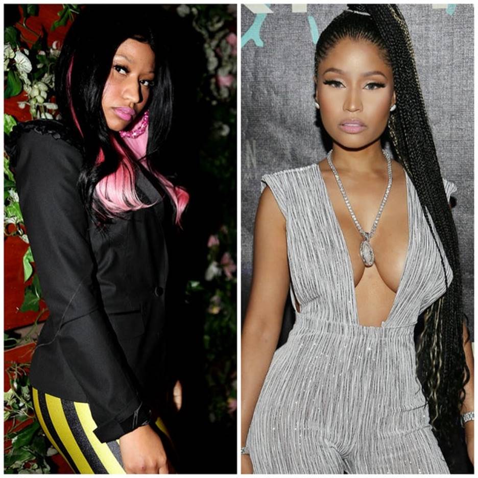 Nicki Minaj Before and After