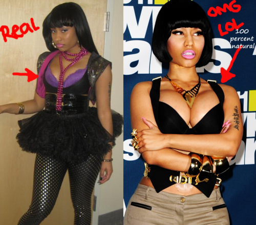 Nicki Minaj Before and After