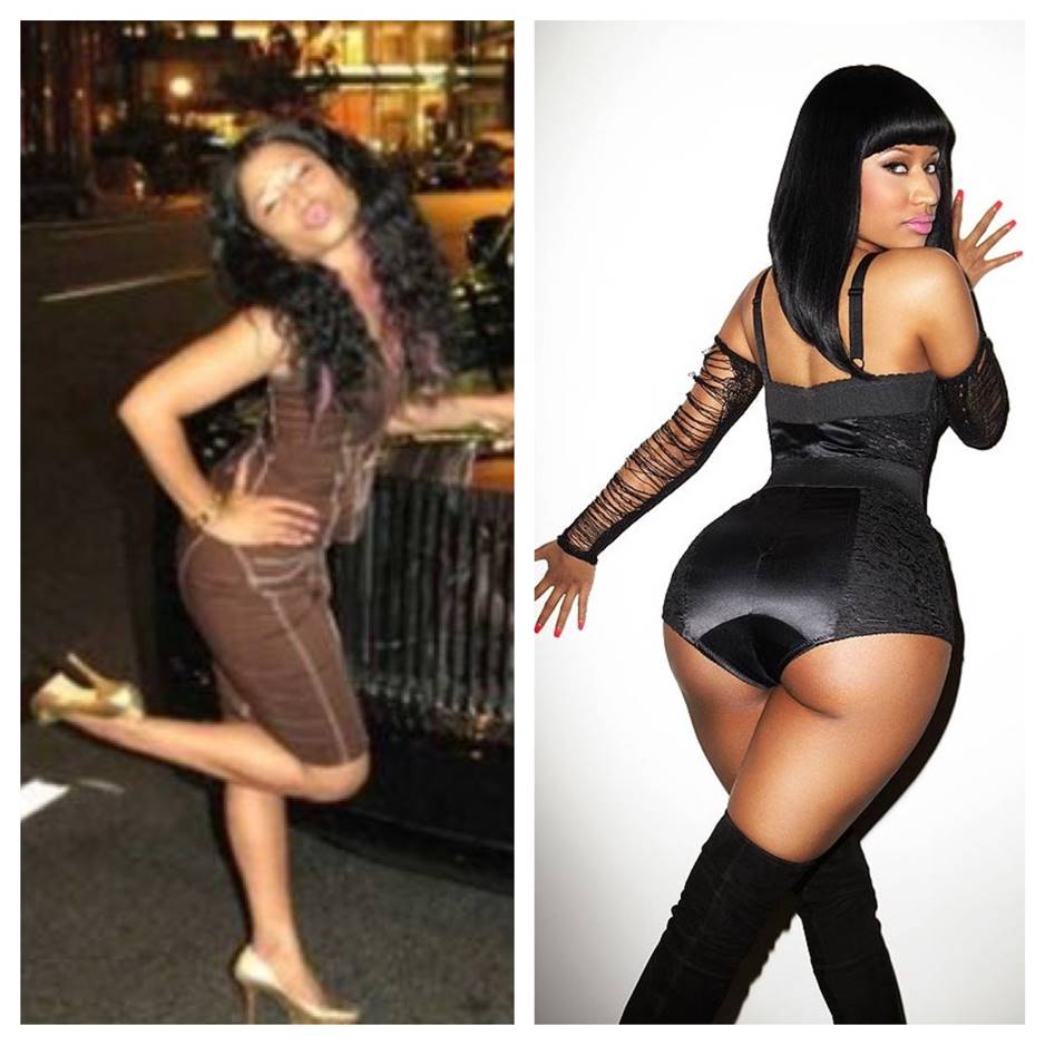 Nicki Minaj Before and After