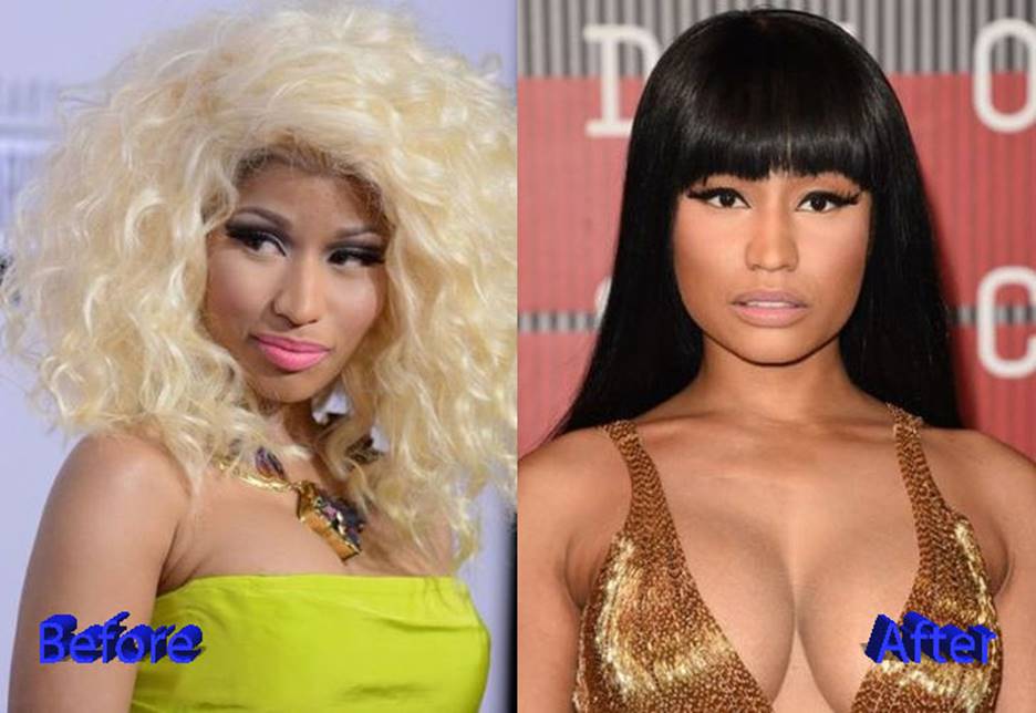Nicki Minaj Before and After